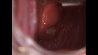 Аважы кӧзгӧ киска пачмыжы доно